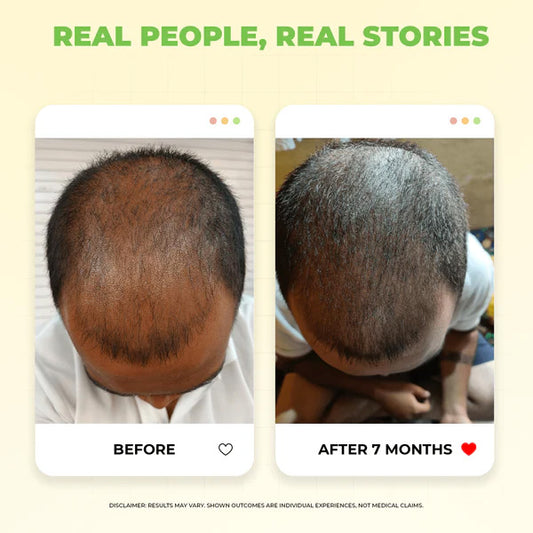 Karma Roots Hair Nourshing Oil - 60ml | Cash On Delivery