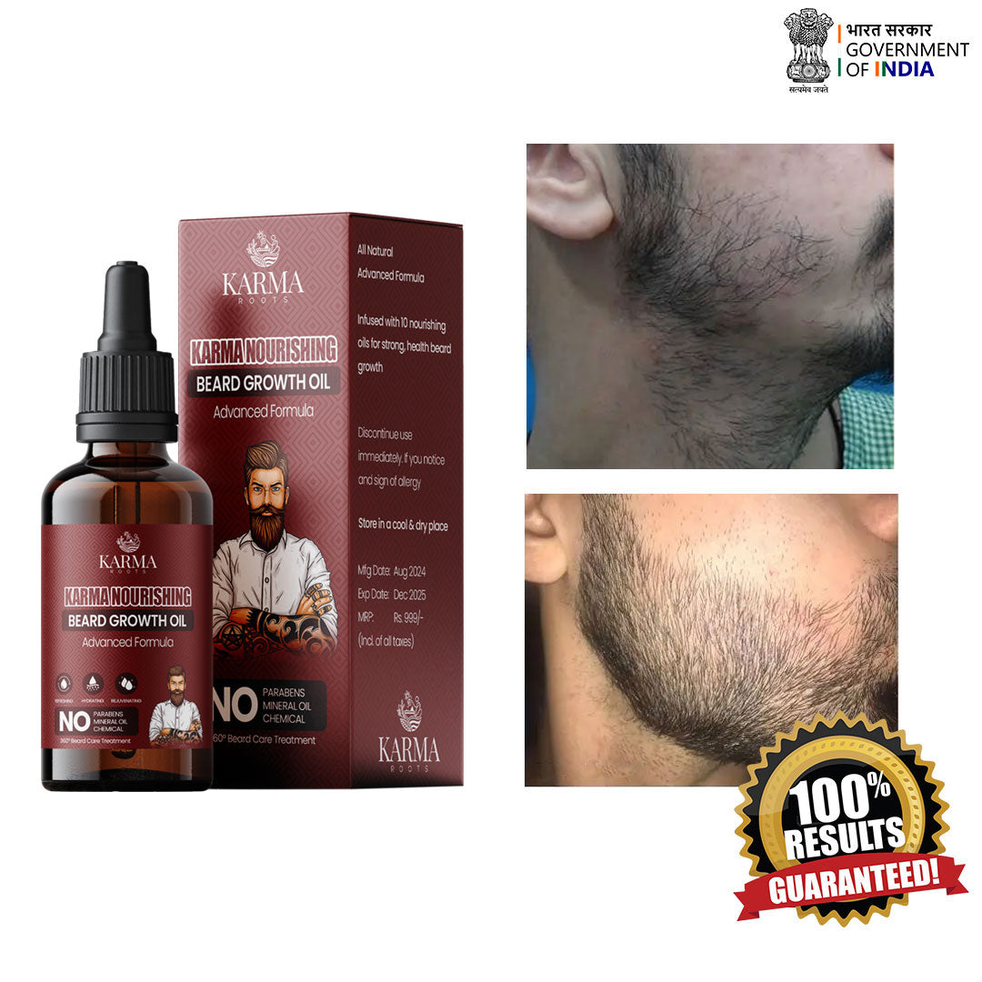 Karma Roots Beard Growth Oil - 30ml | Free Shipping