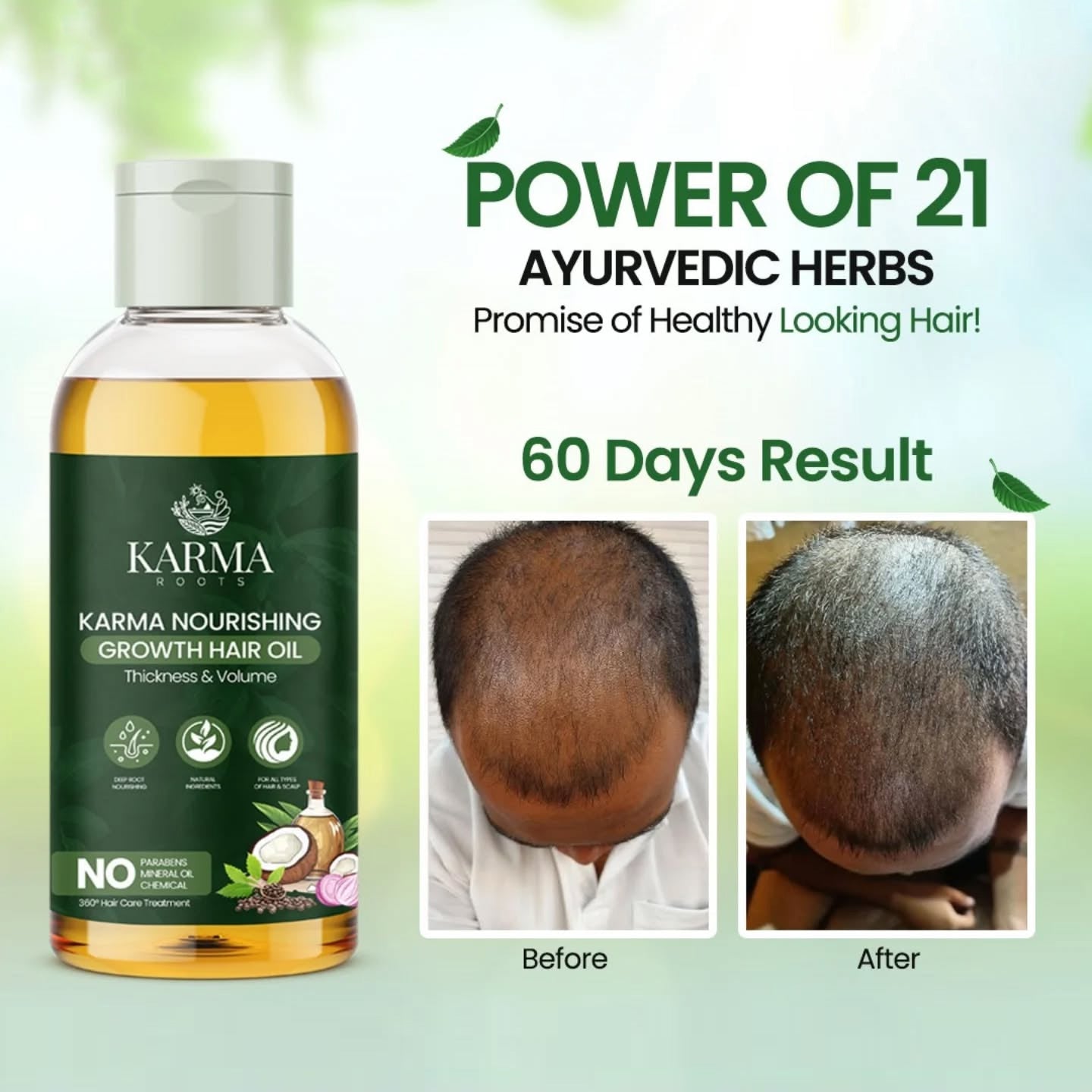 Karma Roots Hair Nourshing Oil - 60ml | Cash On Delivery