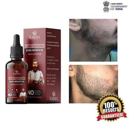Karma Roots Beard Growth Oil  - 30ml | Free Shipping